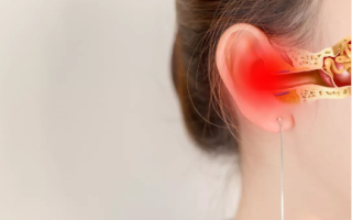 急性化脓性中耳炎