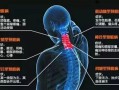 颈椎病、腕关节疼痛的主穴、解结与放血