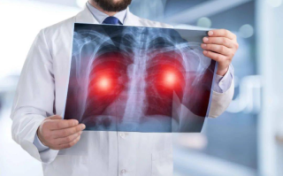 肺癌早期能治好吗？胸透能查出肺癌吗？
