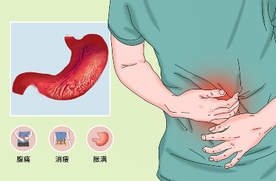 从胃炎到胃癌要经历多久？-图1